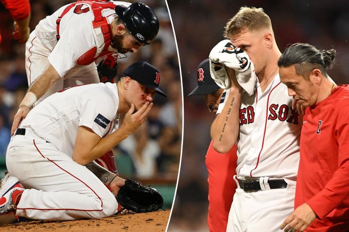 Red Sox starter Houck takes line drive to face, leaves game vs